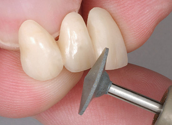 CeraMaster<sup>®</sup> Assorted HP