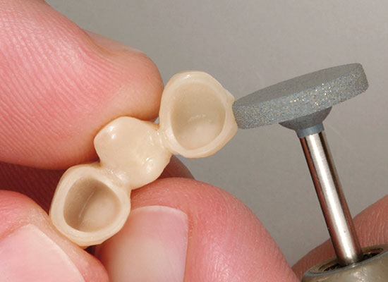 CeraMaster<sup>®</sup> Coarse HP