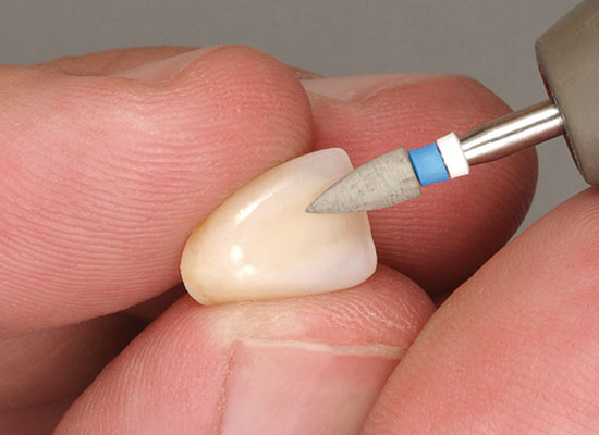 CeraMaster<sup>®</sup> HP