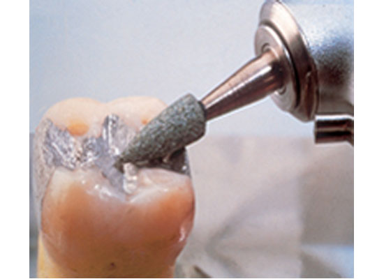 Dura Green<sup>®</sup> Fine HP