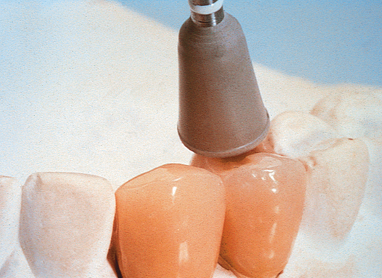 HP Ceramisté<sup>®</sup>